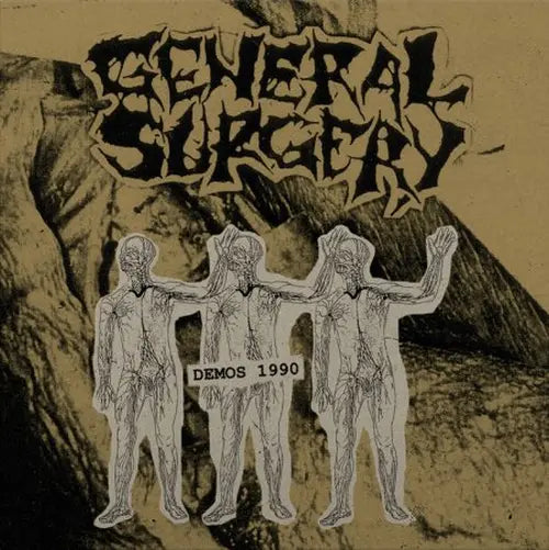 General Surgery - Demos 1990 - Import Diehard Sneezed Pus Splatter Vinyl LP Record