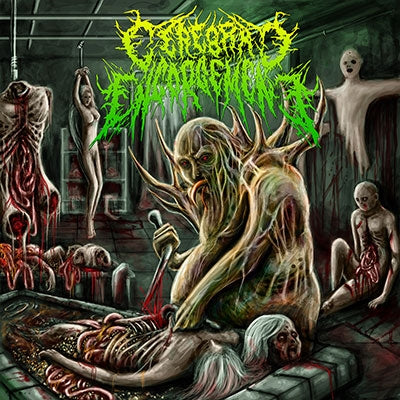 Cerebral Engorgement - Gastrointestinal Bleeding - Import CD