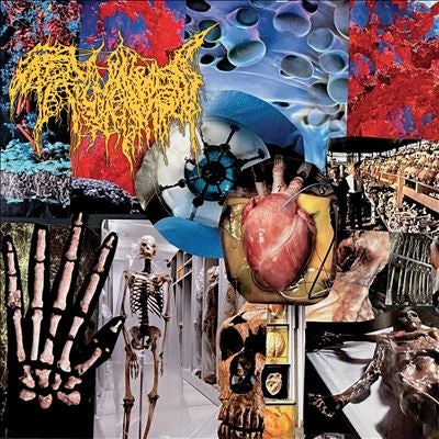 Trichomoniasis  -  Harvest Of The Killing Fields  -  Import CD